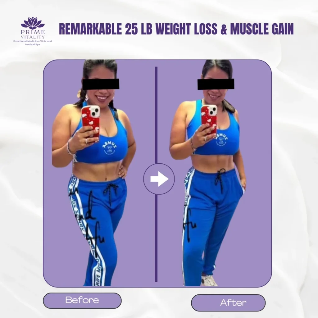 Before and after Semaglutide weight loss patient in San Antonio