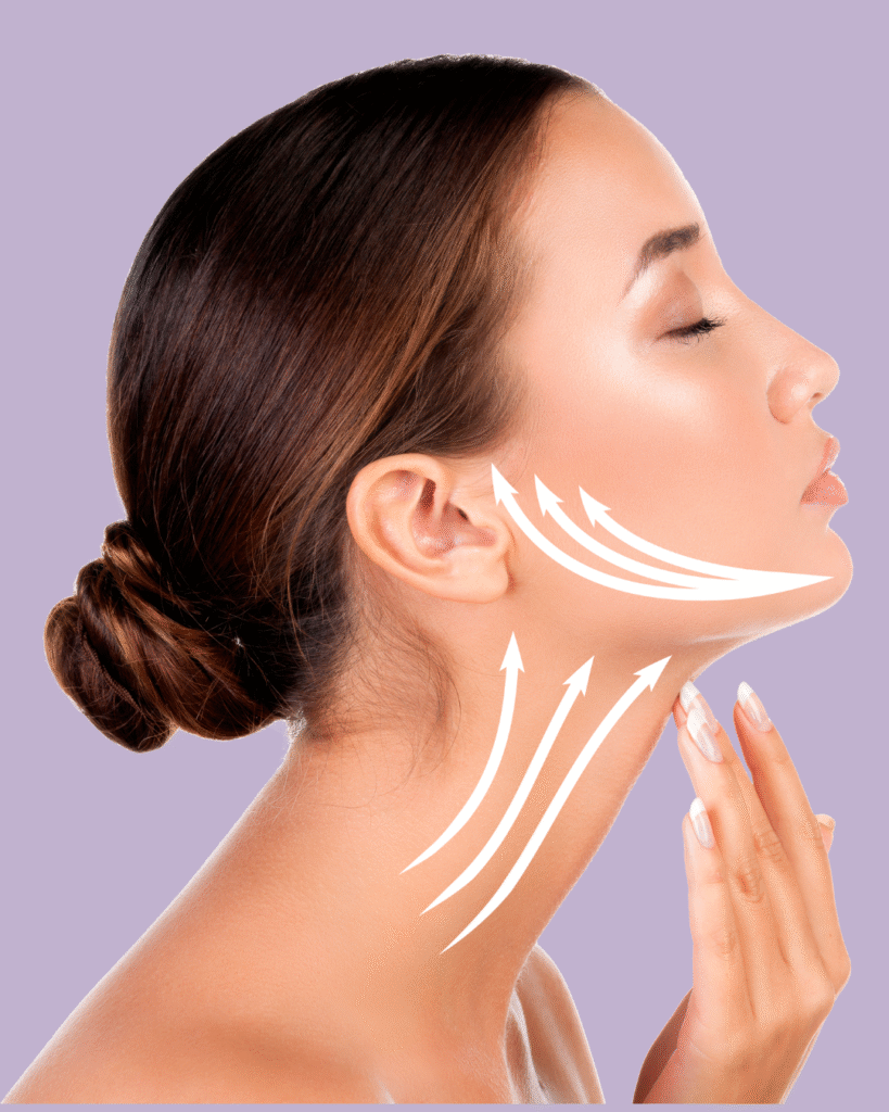 Woman with a side profile demonstrating facial rejuvenation techniques, showcasing arrows indicating lifting and contouring, relevant to Prime Vitality Care's Facial Harmony treatment.