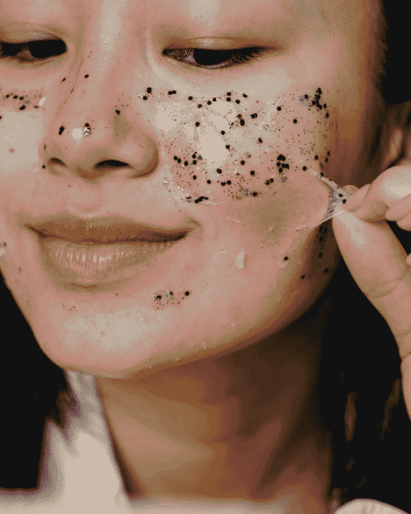 CHEMICAL PEELS