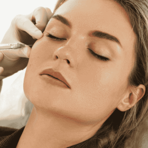 Dermal Fillers