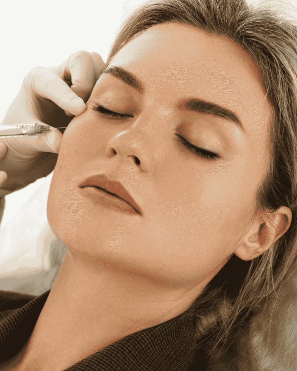 Dermal Fillers