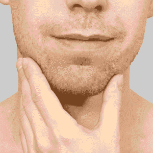 Double Chin Reduction