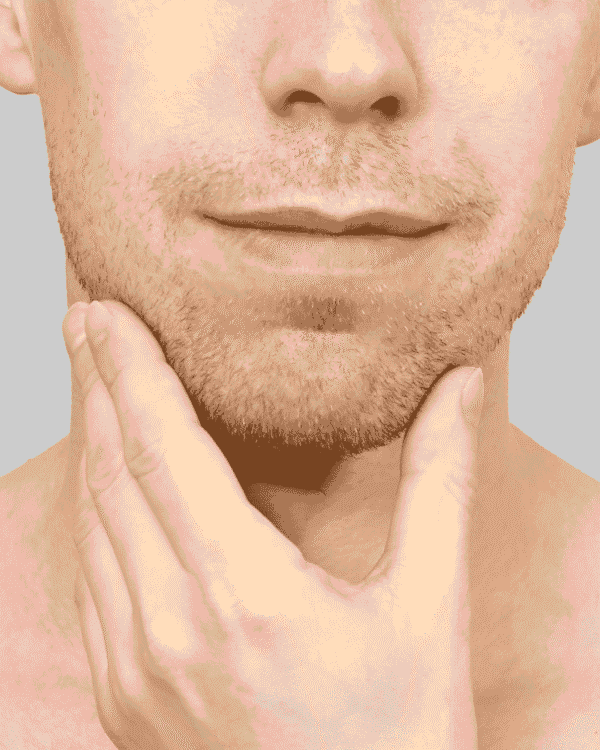 Double Chin Reduction