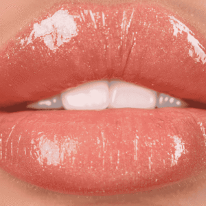 Lipsuction