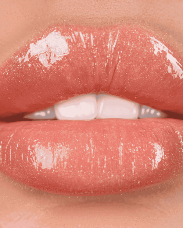 Lipsuction