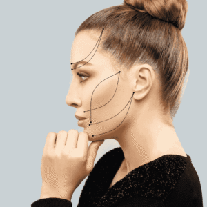 PDO Threadlift
