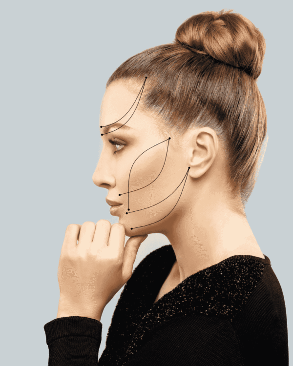 PDO Threadlift